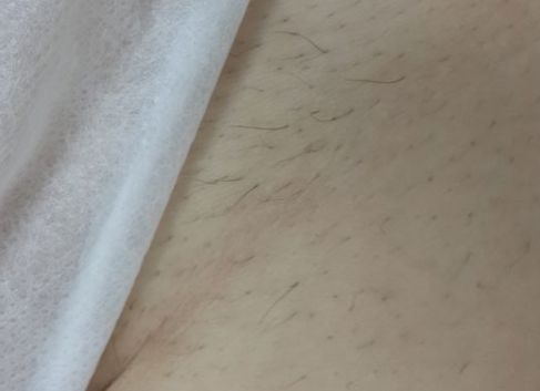 Close-up of light skin and fabric, with fine body hair visible.