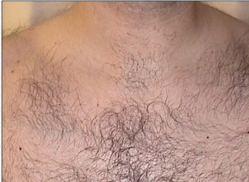 Close-up of a hairy bare chest and upper shoulders against a light background