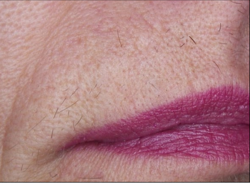 Close-up of a face showing purple lipstick and light facial hair on the upper lip
