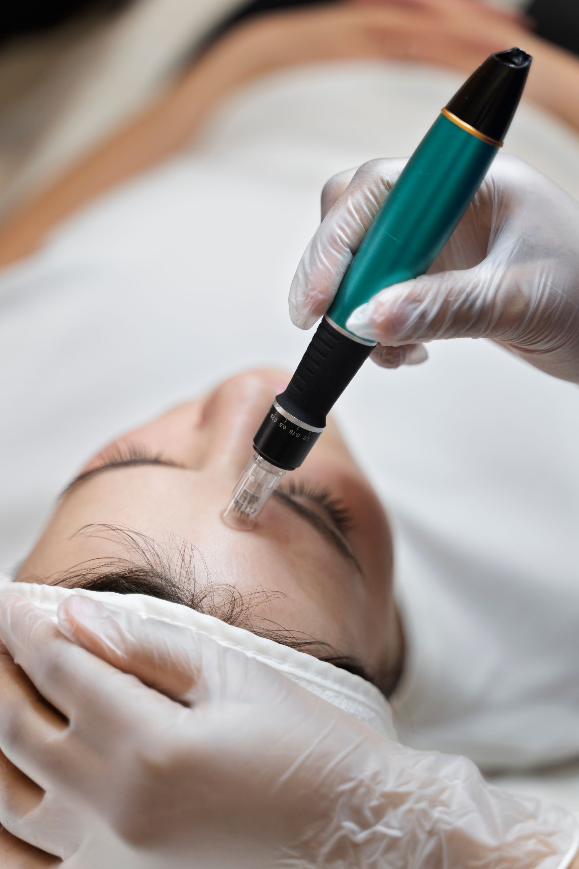 Gloved hands applying cosmetic treatment to a woman’s forehead with a pen-shaped tool