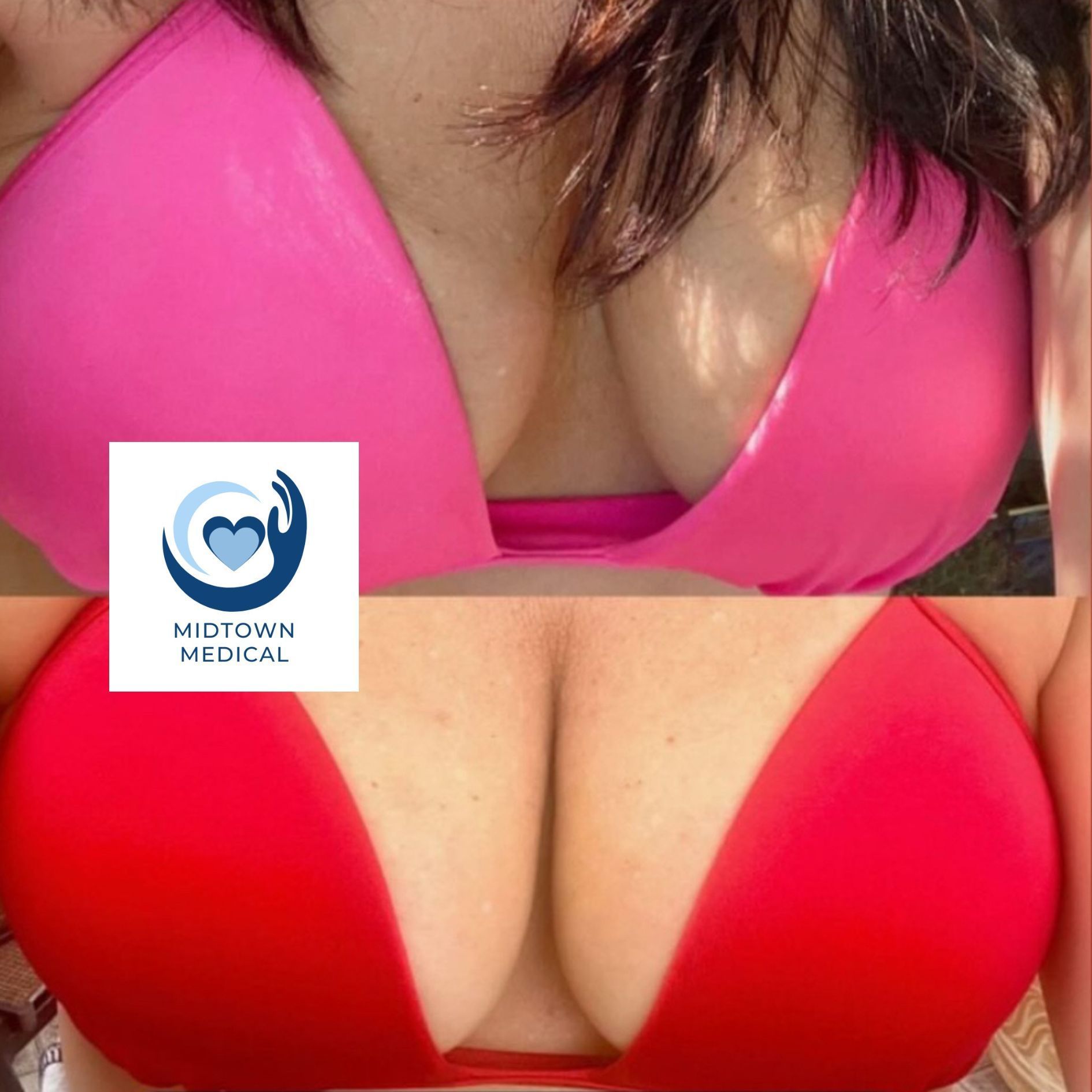 Before-and-after chest photo: pink top above, red top below, with a medical logo overlay.