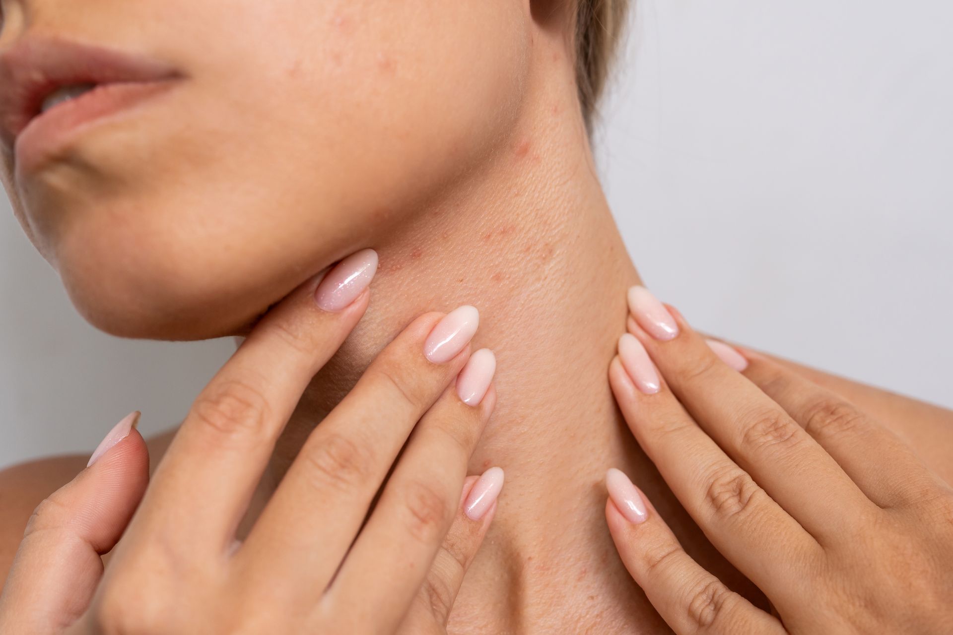 Hands examining a red, irritated neck with small bumps against a plain background