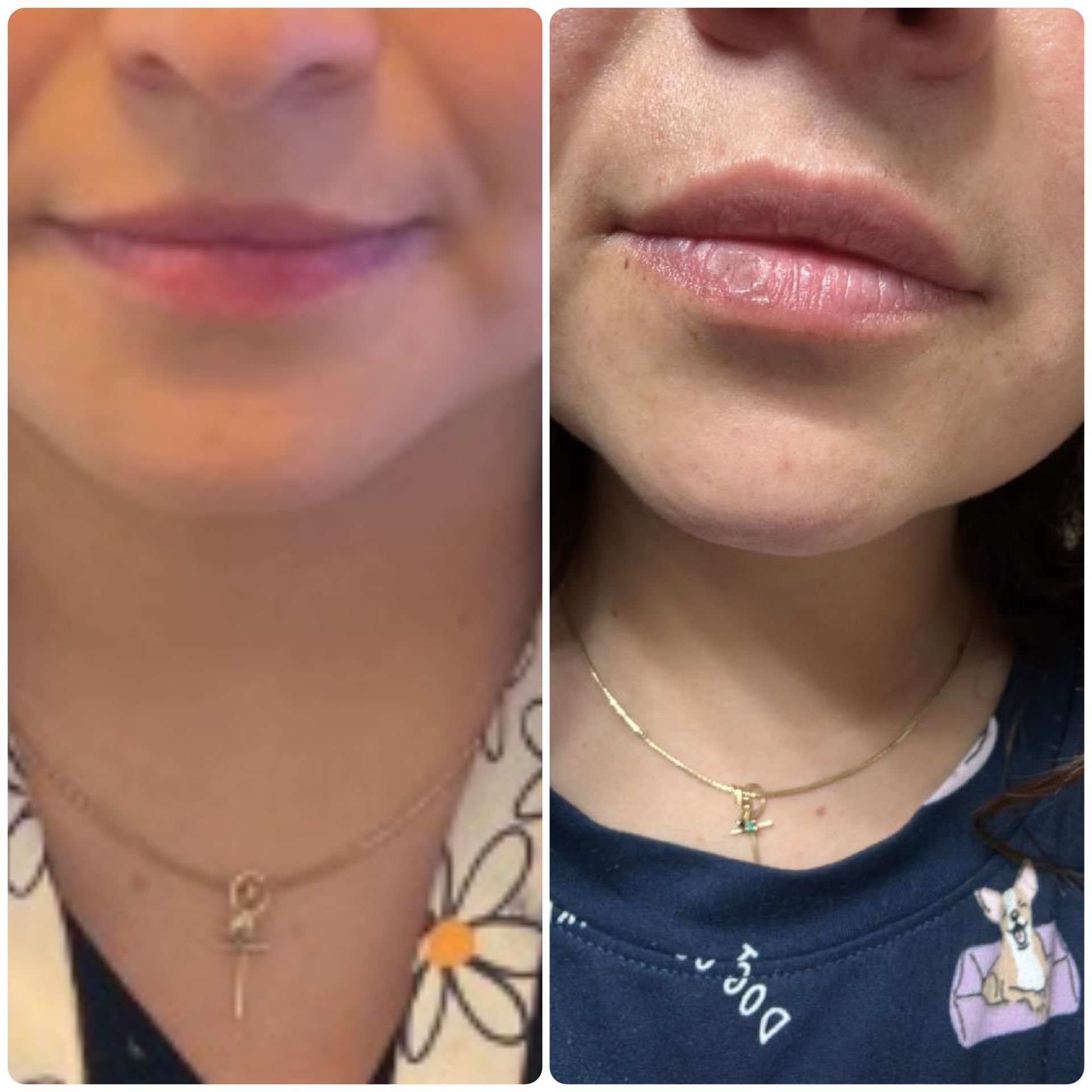 Side-by-side close-ups of lips and lower face, showing a subtle smile and a gold necklace in both views.