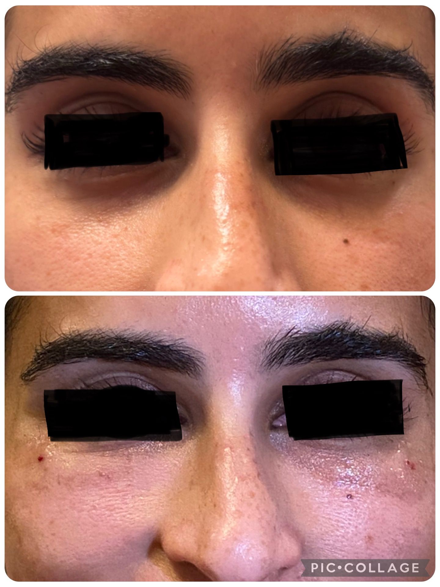Close-up before-and-after of eyes with dark under-eye circles and makeup, showing skin texture changes
