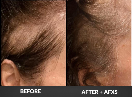 Split before-and-after close-up of a scalp, showing thinning hair on the left and fuller hair on the right.