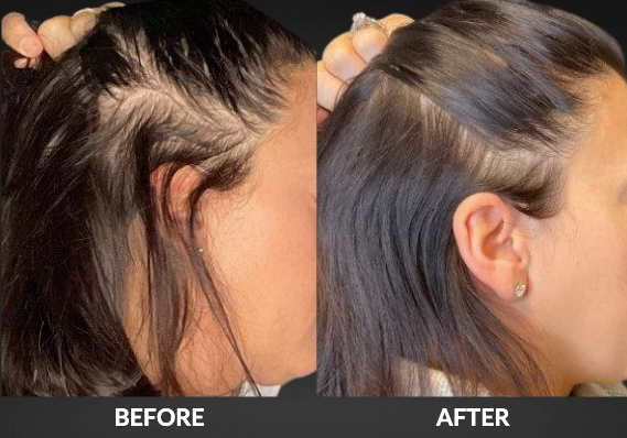 Split-screen before-and-after of a slicked-back hairstyle on a woman’s side profile