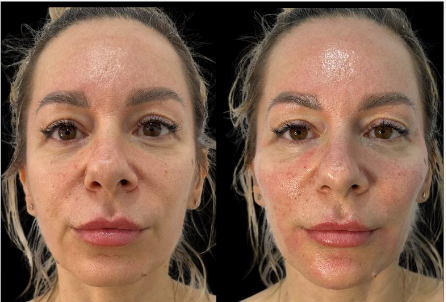 Side-by-side close-up of a face before and after makeup, with a shiny dewy finish