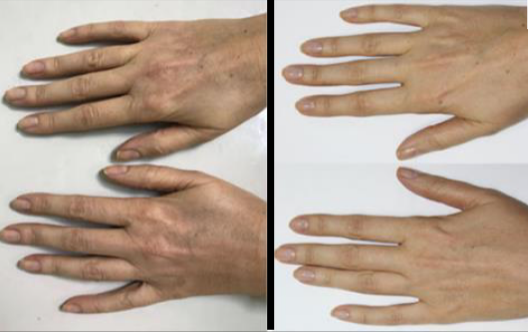Two hands shown side by side, one set on the left and one on the right, with fingers extended.