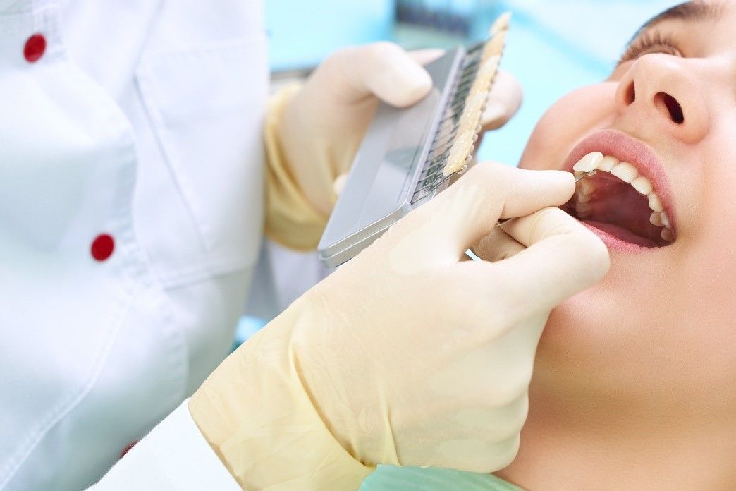 Porcelain Veneers | Dentist Using a Palette Tooth Color Sample