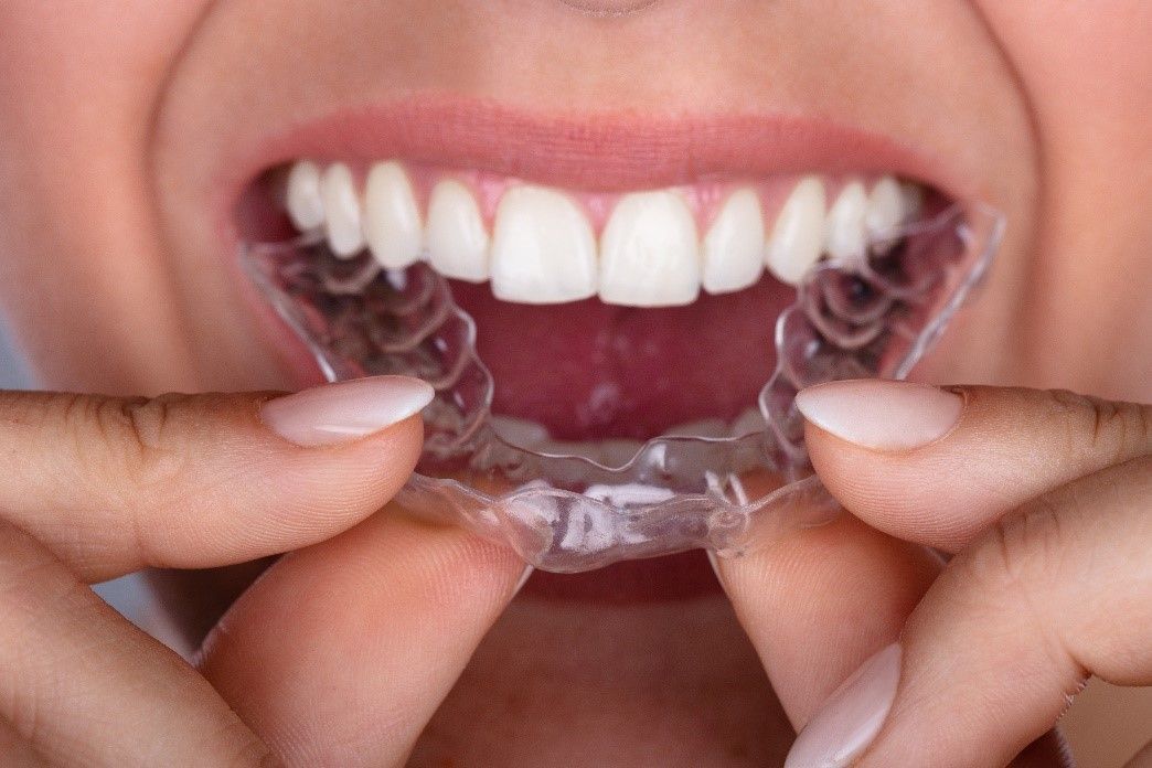 Teeth Straightening | Woman Putting Transparent Aligner