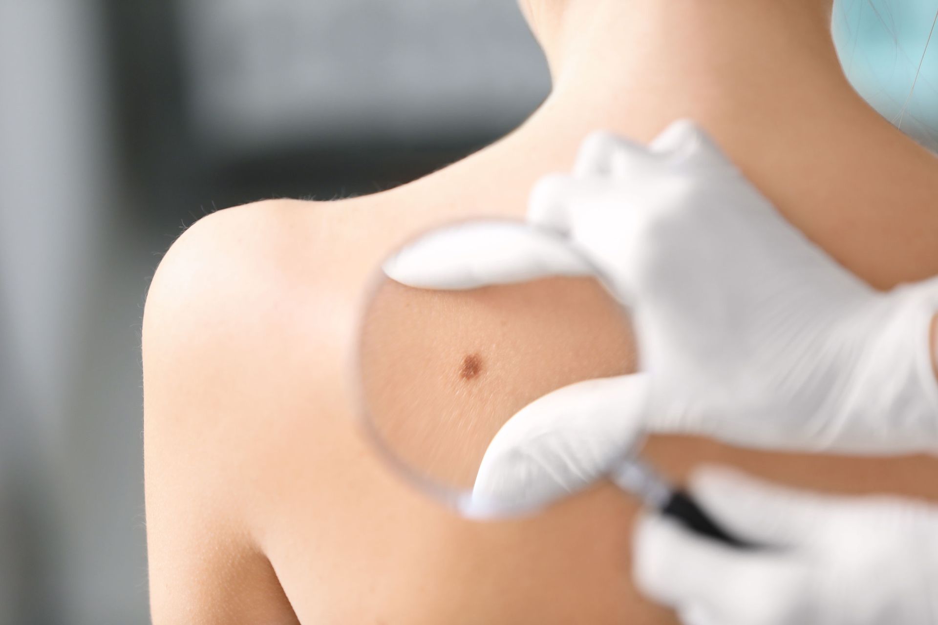 Trusted dermatologist in Ocala FL for skin cancer prevention and treatment