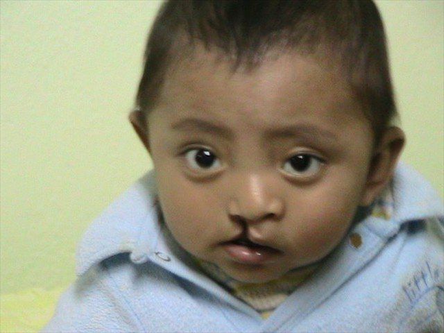 Close-up of a child wearing a light blue shirt, looking at the camera with a neutral expression