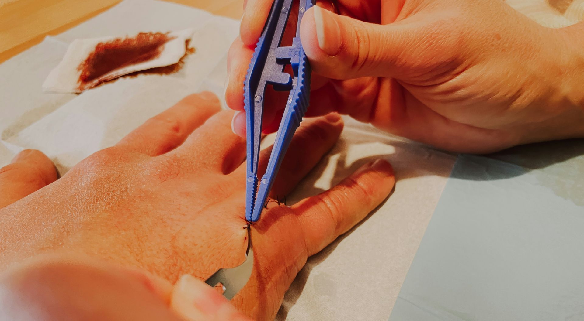 A person is holding a pair of tweezers over a person 's hand.