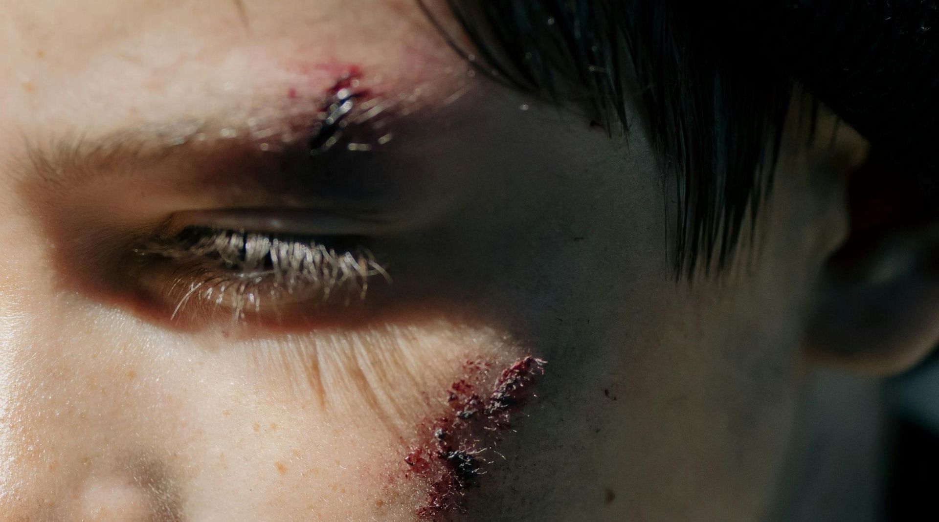 injured boy