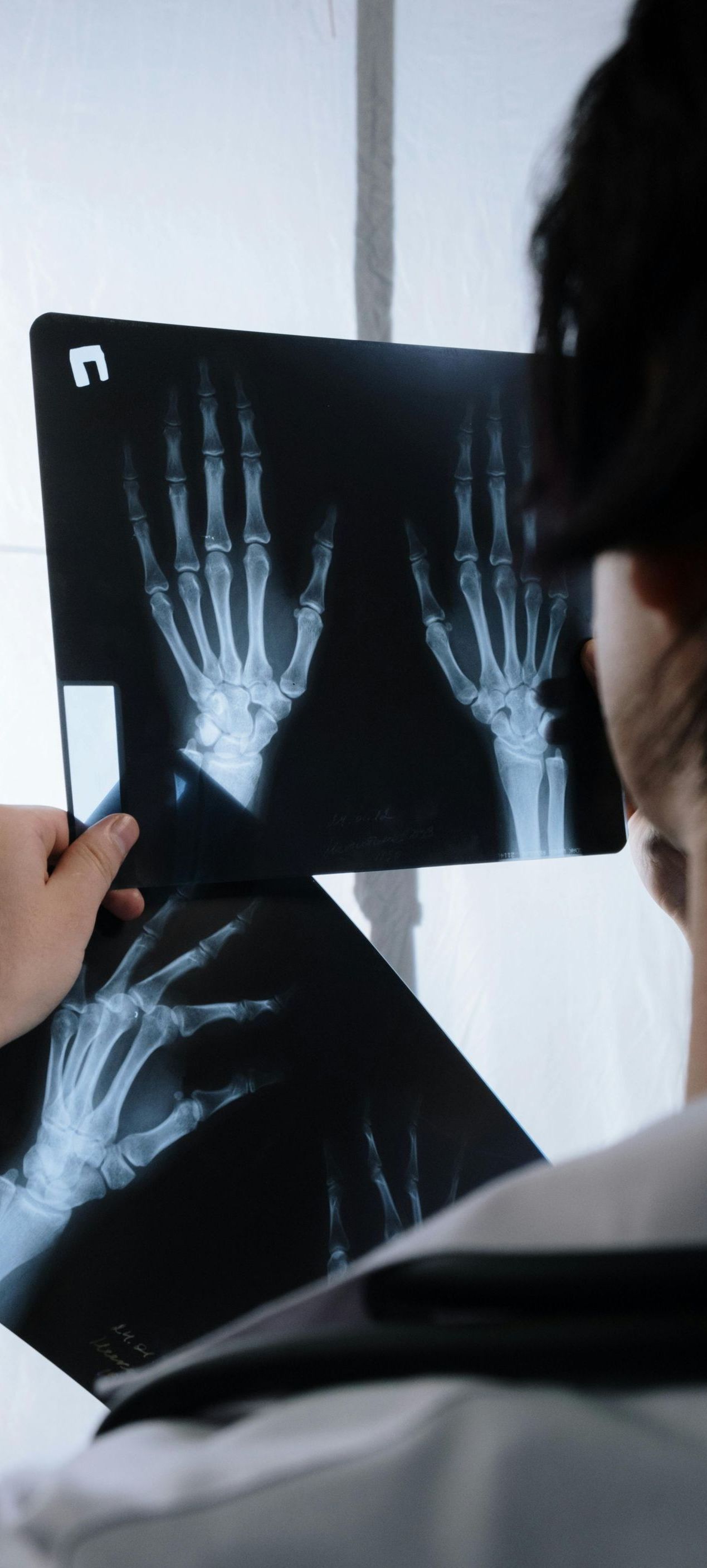 doctor looking at an xray