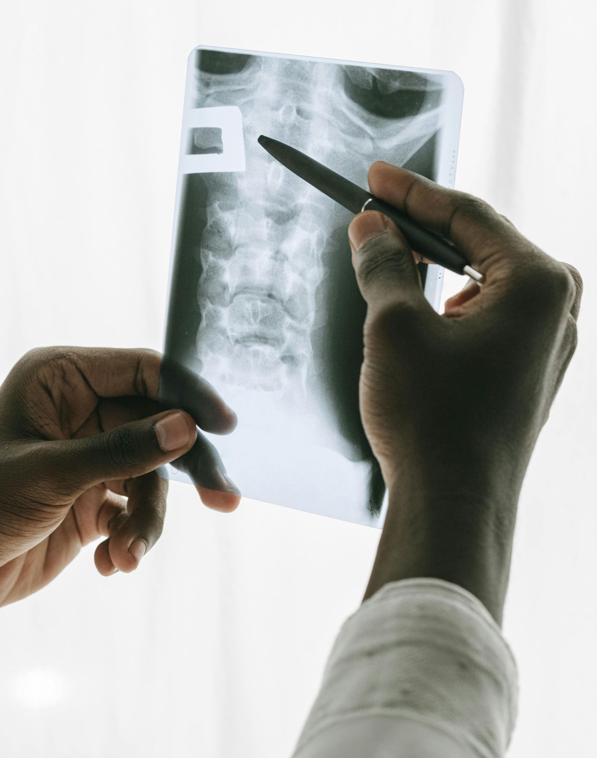doctor holding an xray