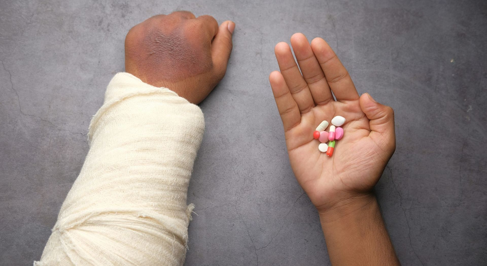 A person with a cast on their arm is holding a handful of pills.