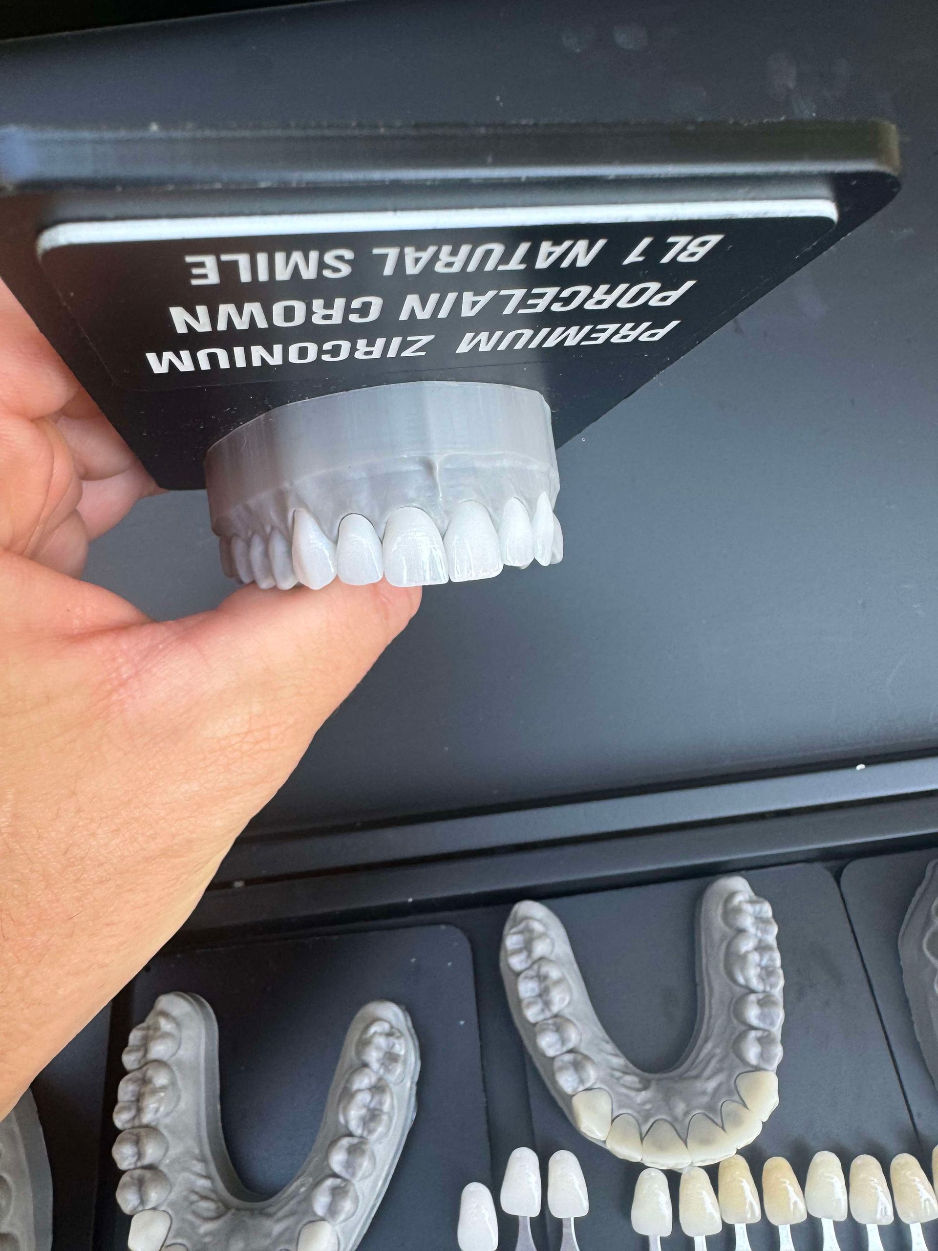 Hand holding a model of upper teeth, labeled 