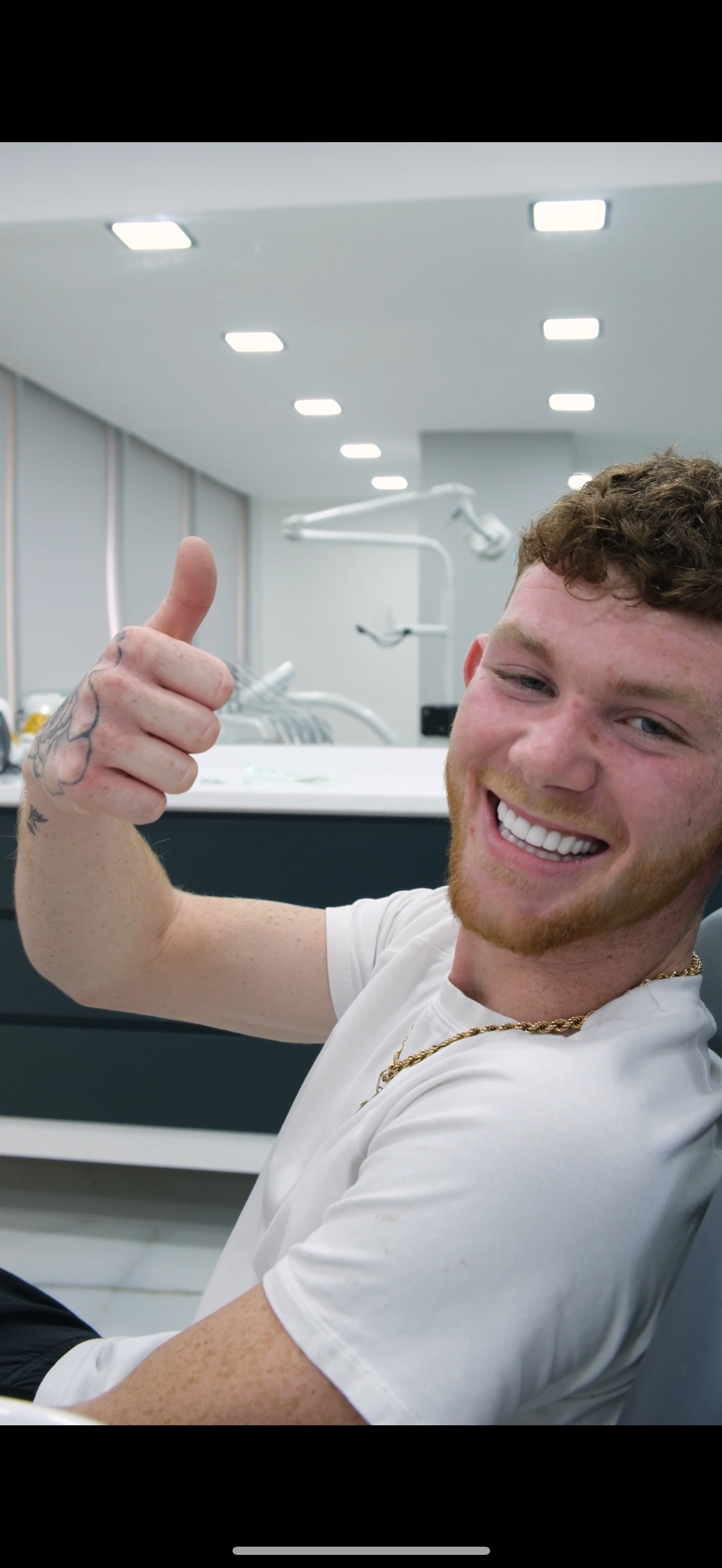 Man smiles with thumbs up at dental office, showing off new white teeth.