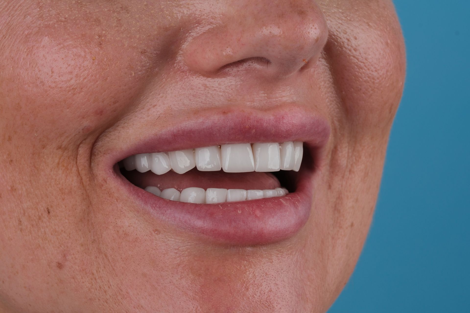 Woman smiling, showing white teeth against pink lips, set against a blue background.