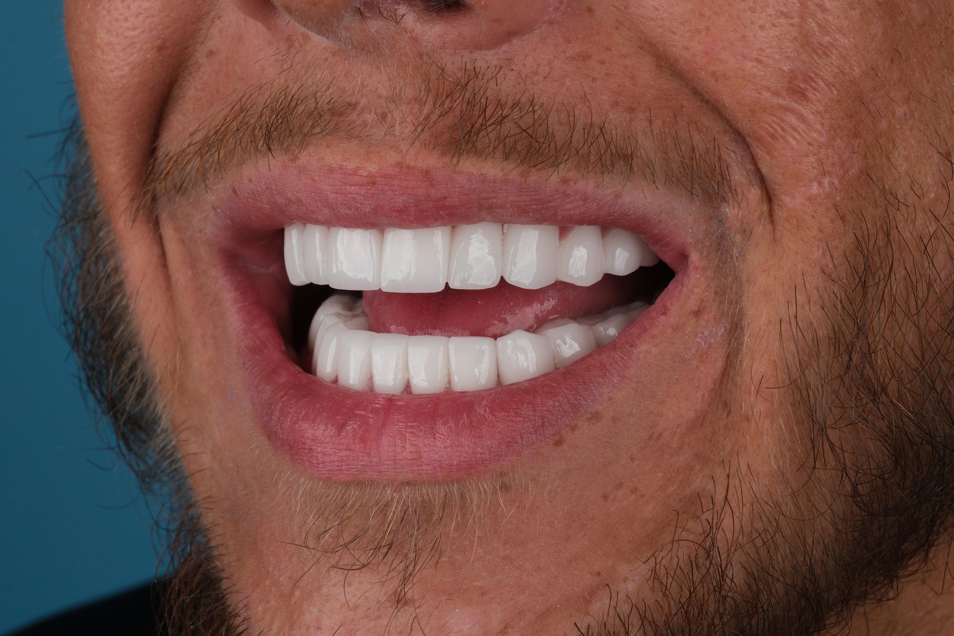 Close-up of a man smiling, showing bright white teeth. Blue background.