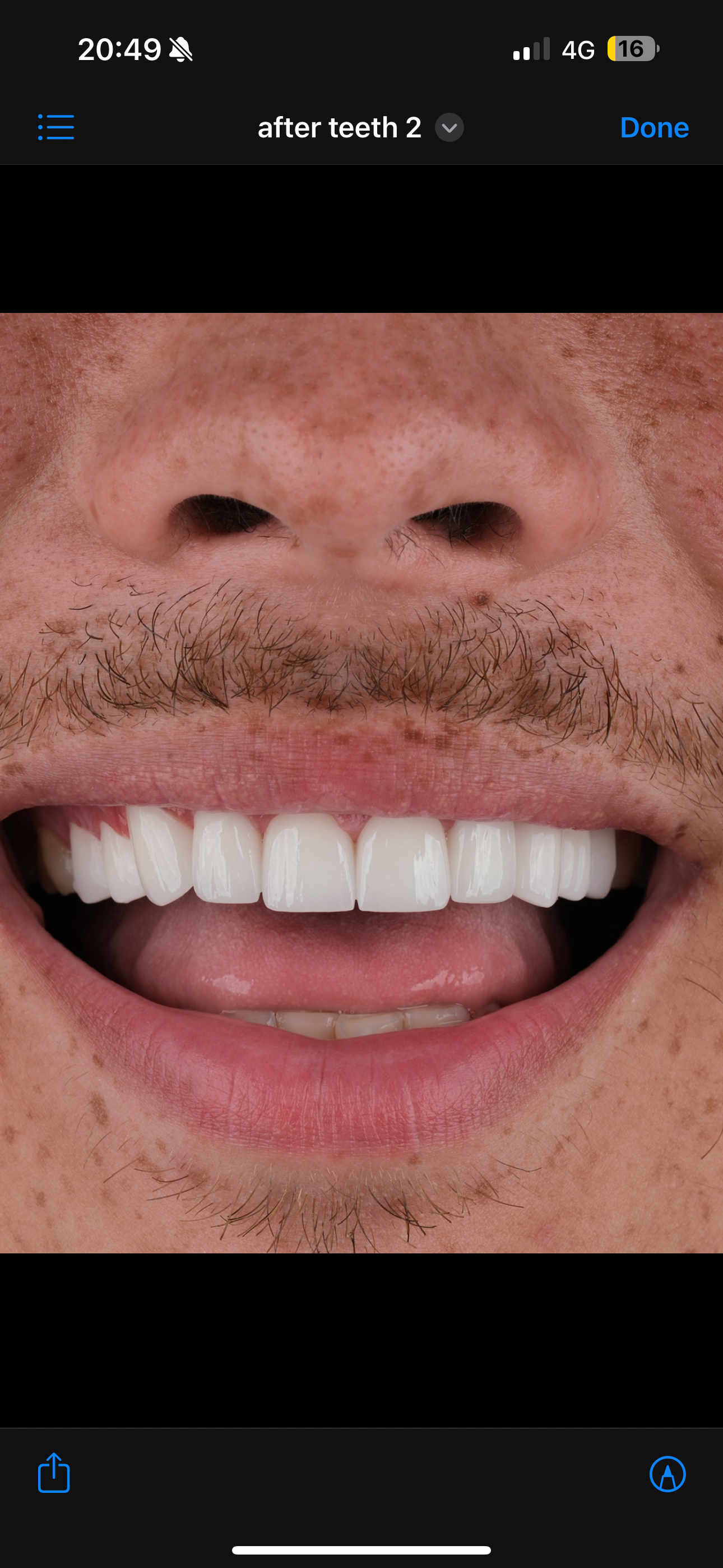 Close-up of a smiling person with a mustache, showing bright white teeth.