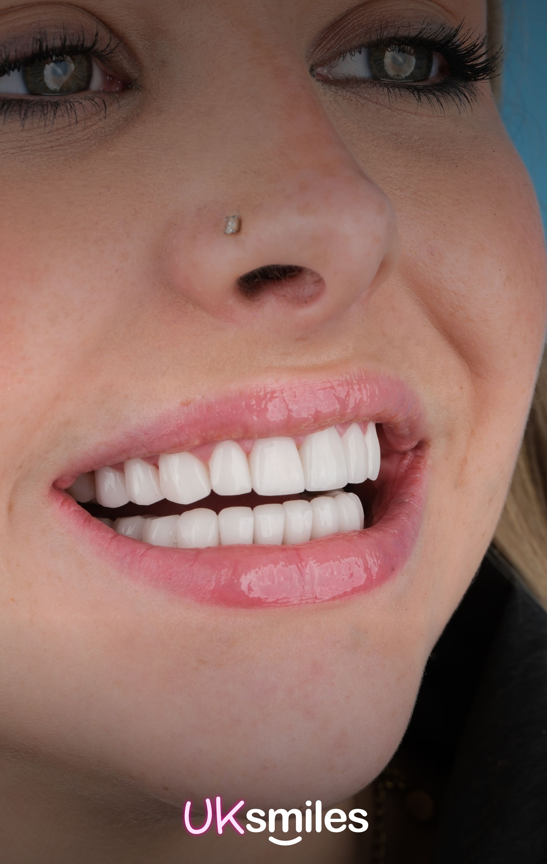 Women smiling with white turkey teeth