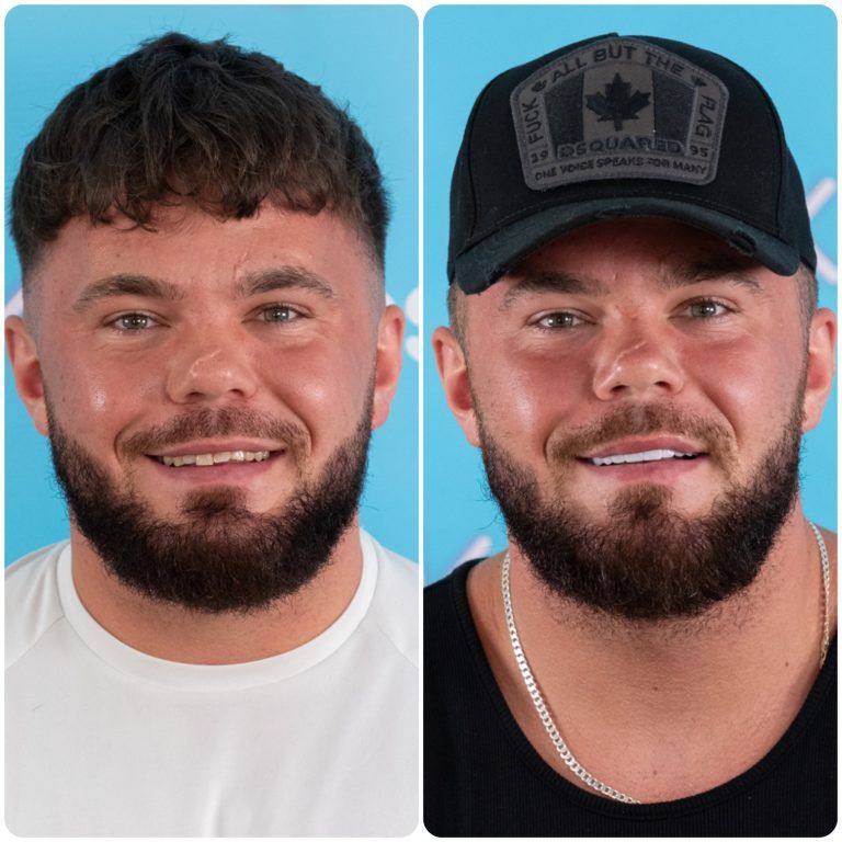 Two side-by-side portraits of a man; left has a white shirt, right has a black hat and shirt.