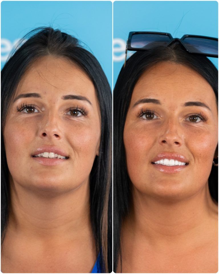 Side-by-side comparison of a woman's face. Left: natural; Right: with makeup, tan and sunglasses on head.