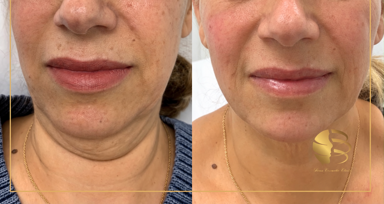 a woman is getting a facial treatment at a spa .