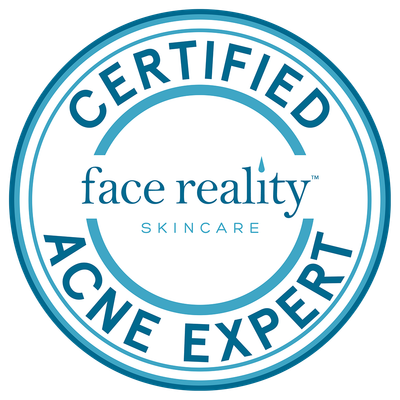 Acne treatments in Boerne, TX by a certified acne expert