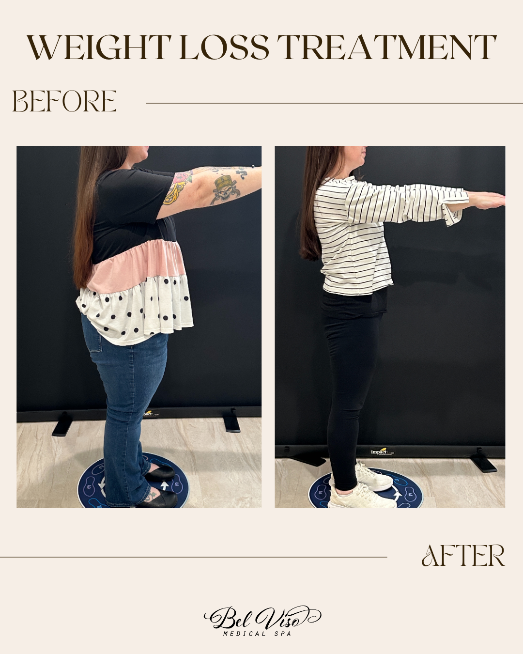 Before-and-after weight loss comparison of a person in side view, showing slimmer silhouette after treatment.