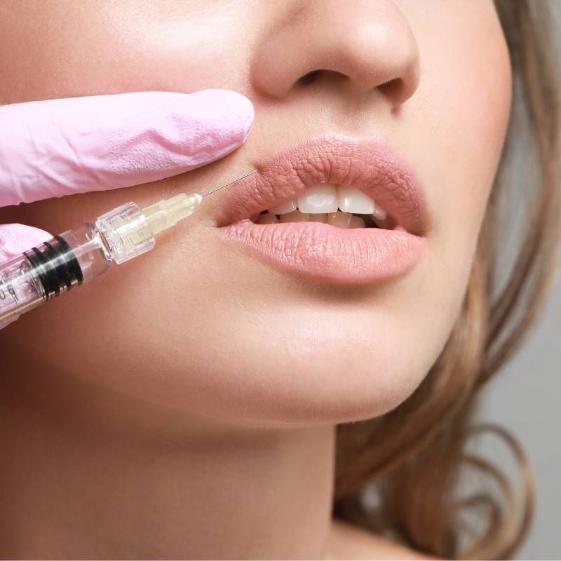 Close-up of a syringe injecting lips, with a gloved hand and natural pink lipstick.