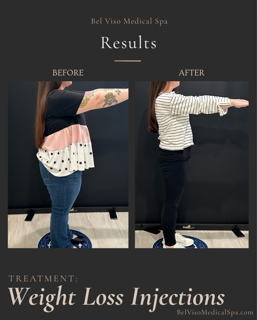 Before-and-after weight loss results: two side-view photos of a person standing with arms outstretched.