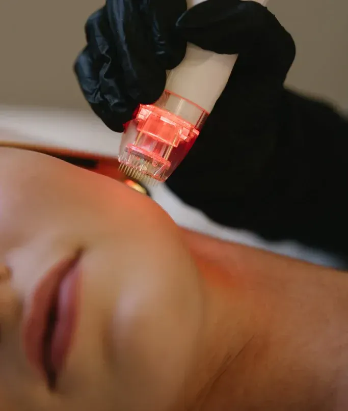 Gloved hand using a glowing red treatment device on a person’s face during a skin treatment