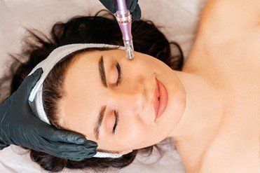 Woman receiving micro-needling treatment on her face. A gloved hand holds the device.