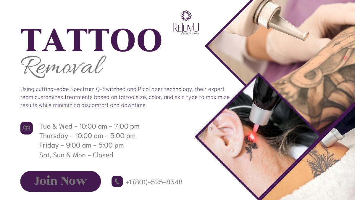 Advertisement for tattoo removal; includes business name, hours, and photos of laser treatment.