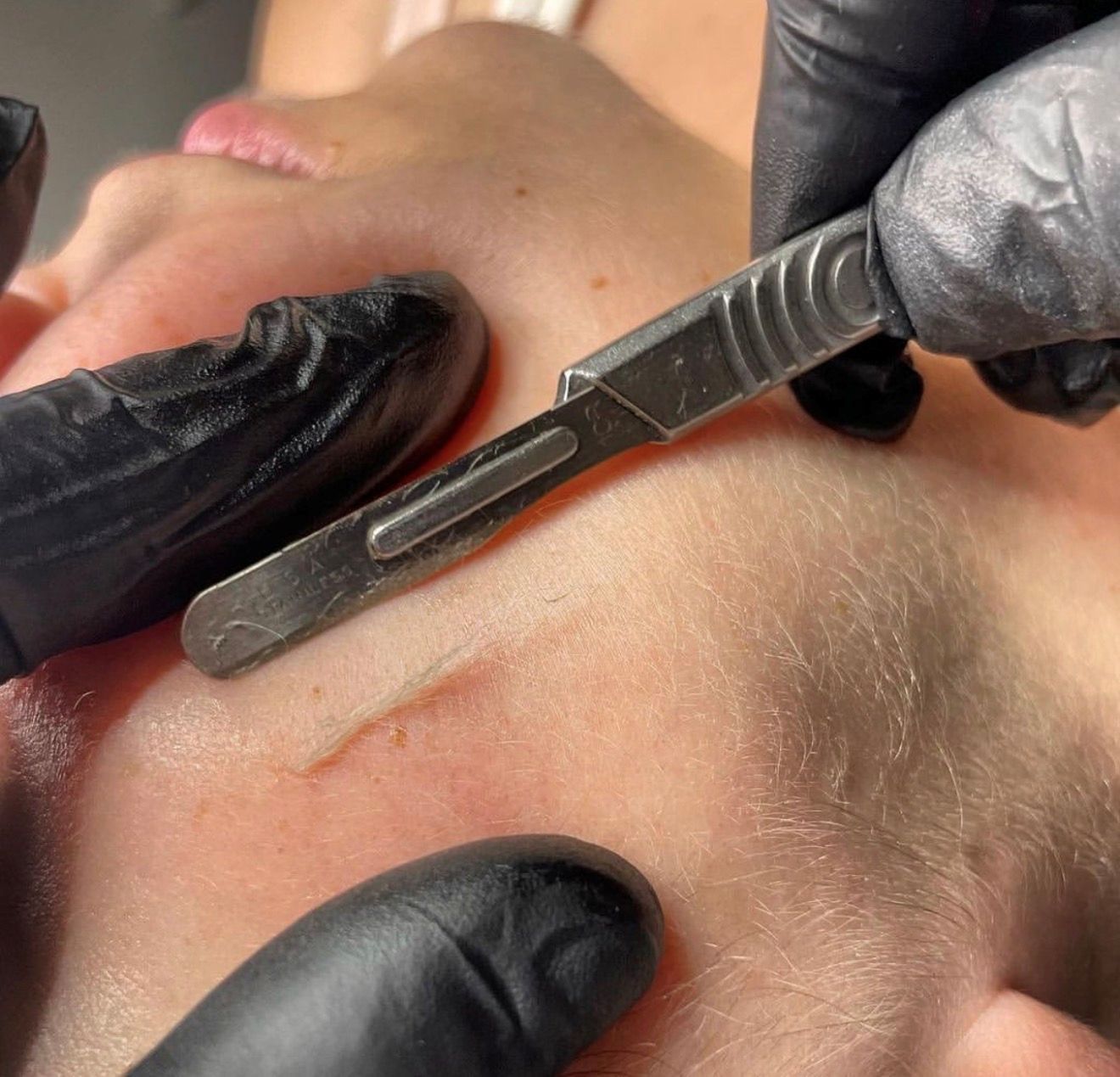 Licensed esthetician performing a professional dermaplaning facial near Syracuse, UT