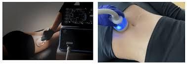 Two photos: a person receiving ultrasound treatment on their back; a device used on a person's abdomen.