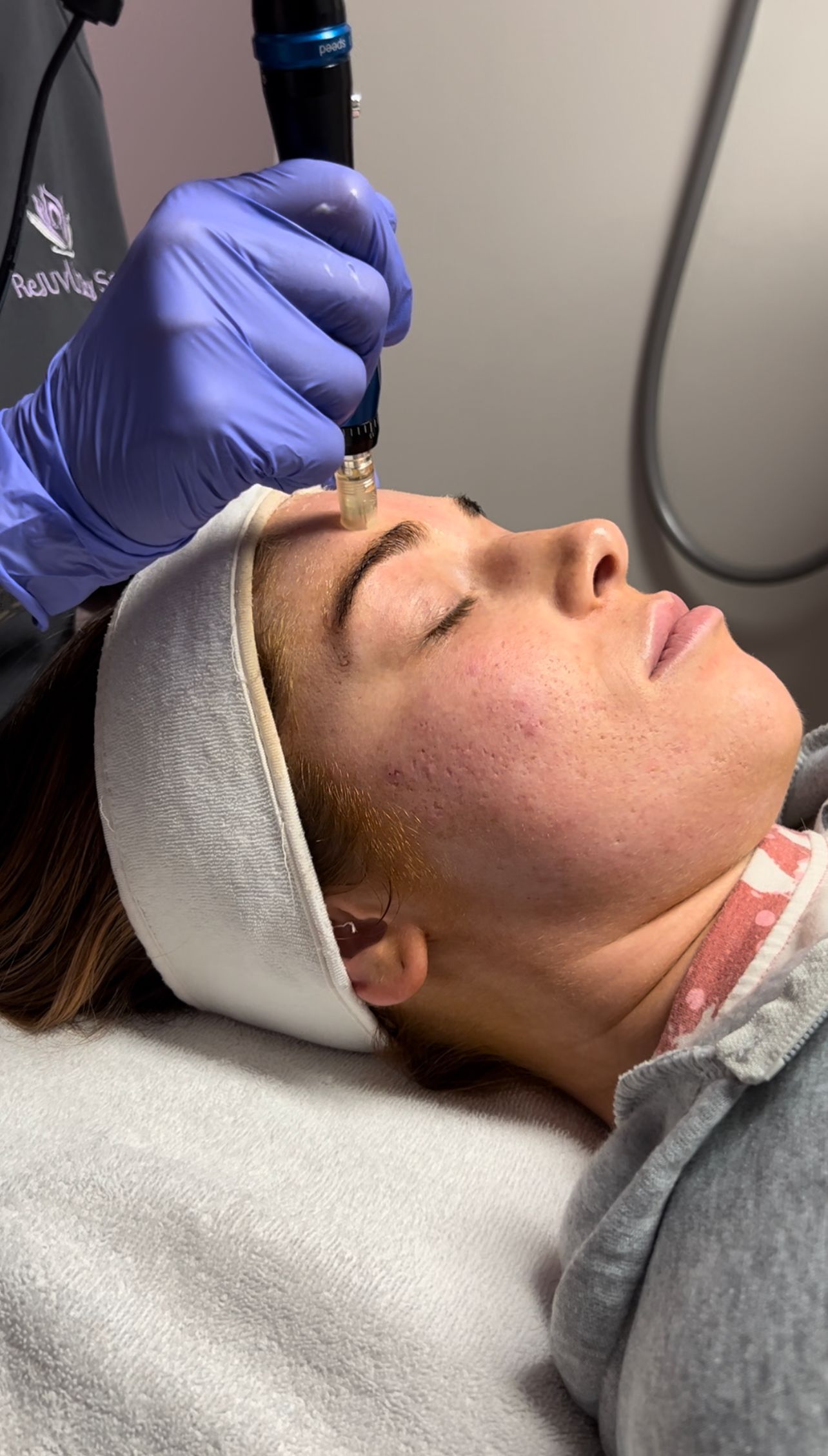 Master esthetician performing an InnoPen microneedling treatment in Davis County, UT