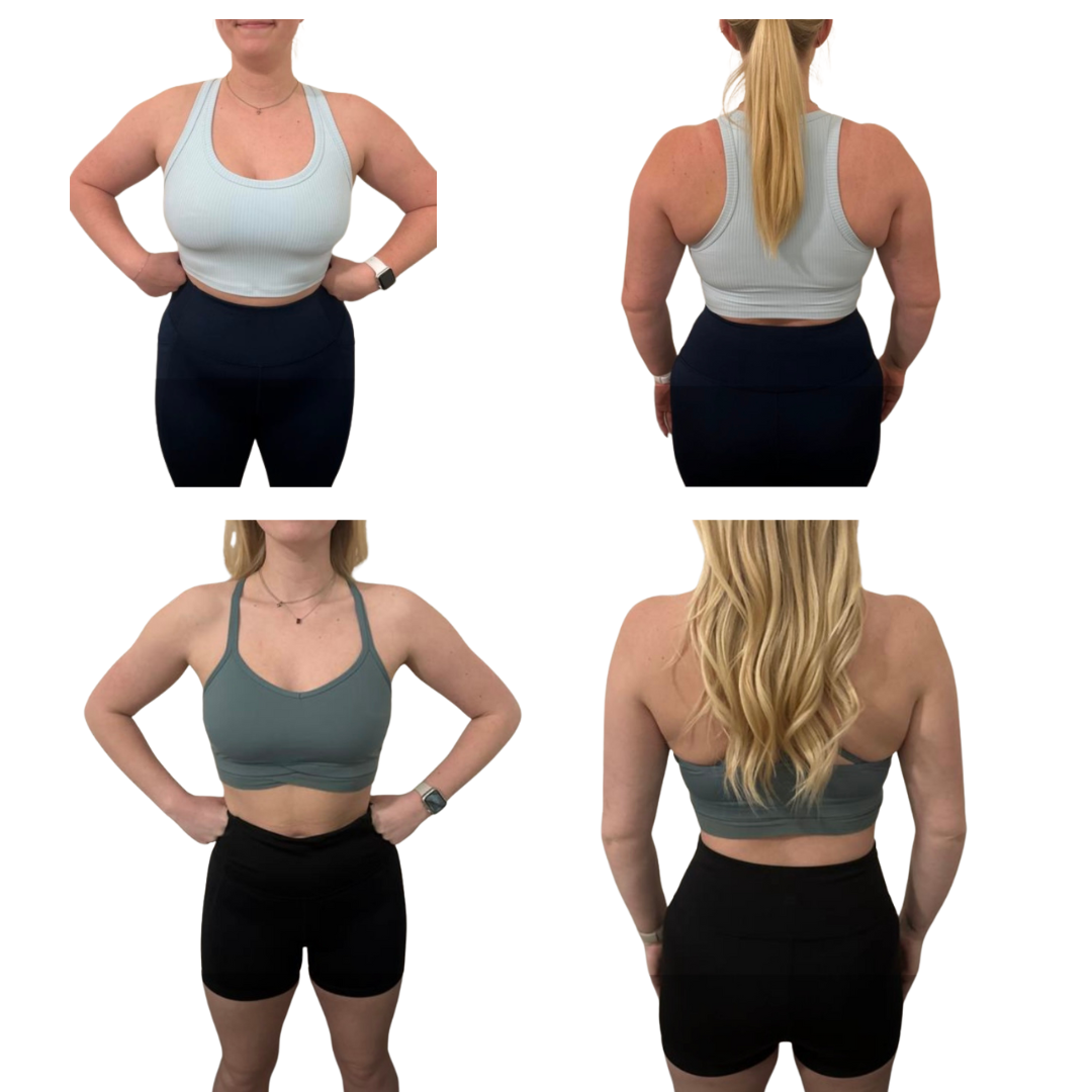 Before and after medical weight loss patient results at ReJuvU Beauty Haven in West Point, Utah.