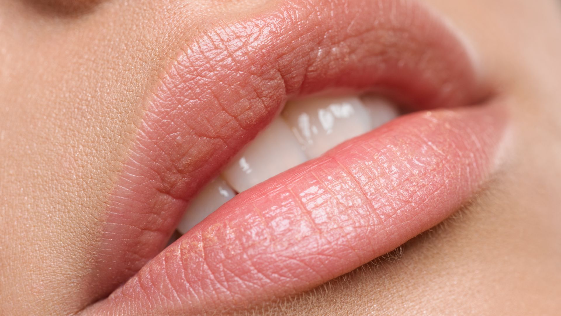 Lip Flip Treatments