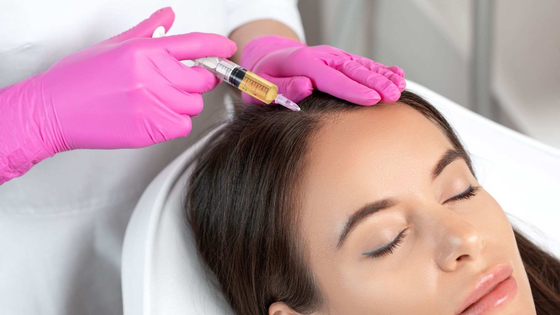 PRP Hair Restoration