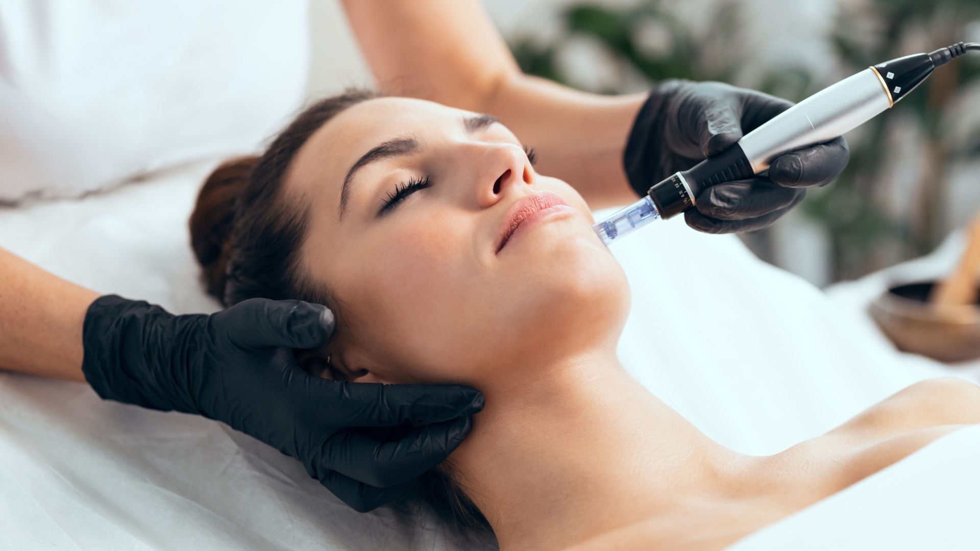 Microneedling Treatments