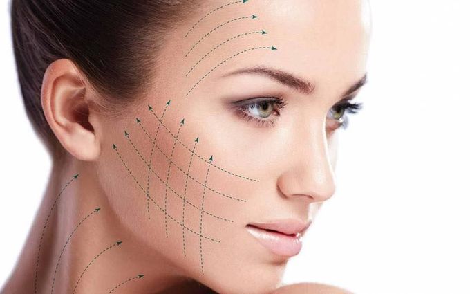 Un volto con linee tratteggiate e frecce direzionali sovrapposte alla pelle per indicare le aree da trattare a scopo estetico.