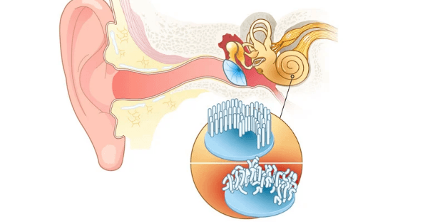 diagram of inner ear showing causes of tinnitus