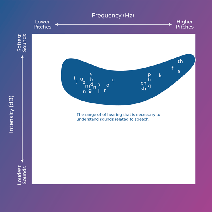 audiogram diagram