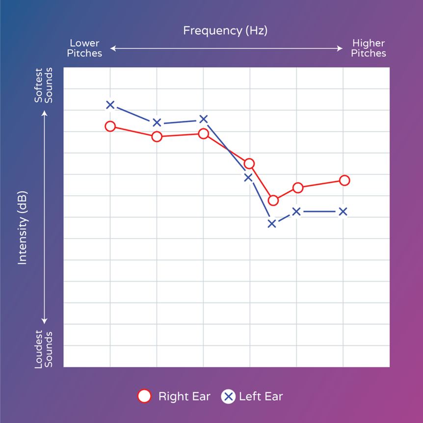 audiogram line graph