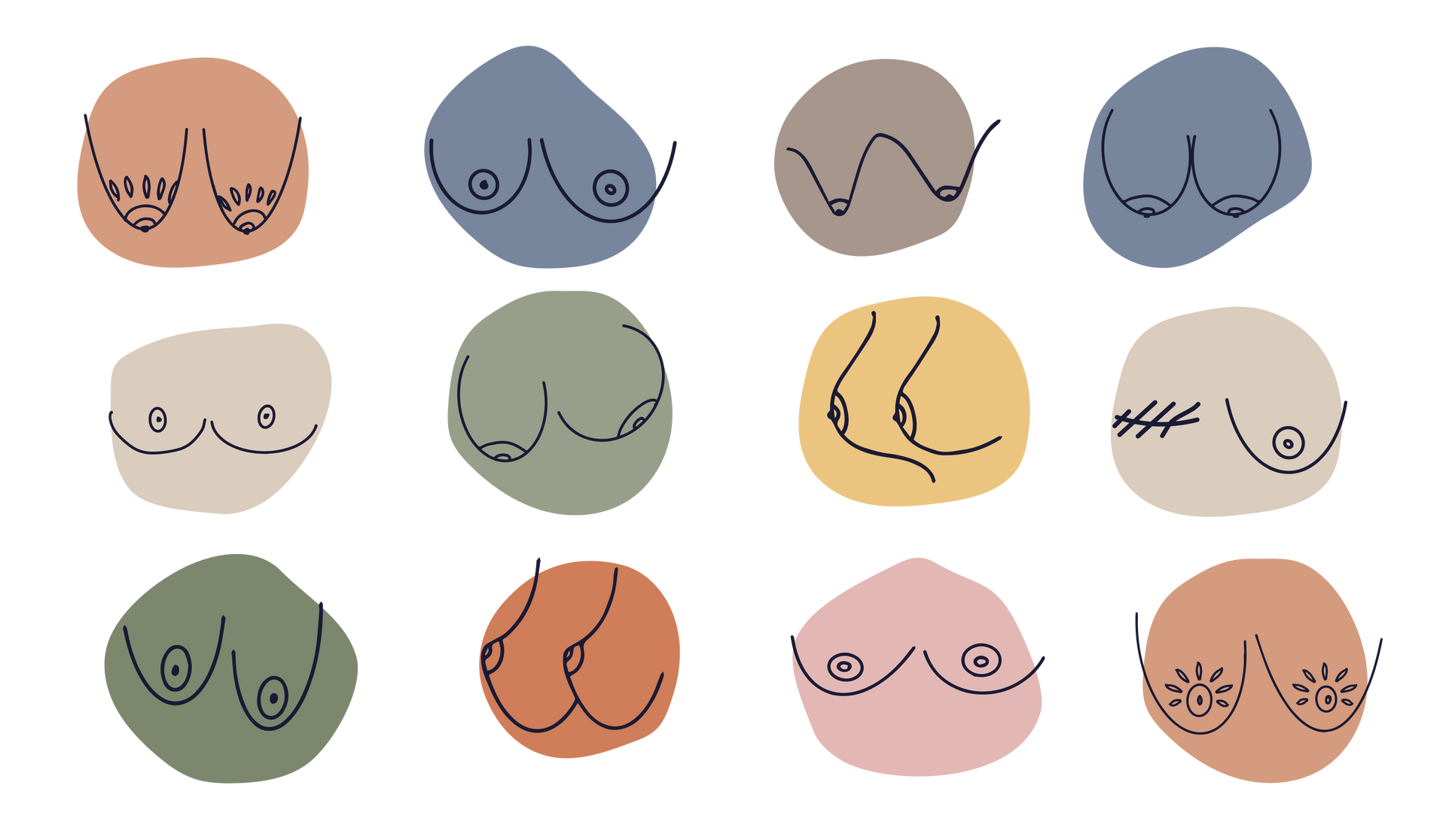 Different types of breast