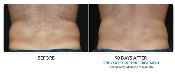a before and after picture of a man 's back